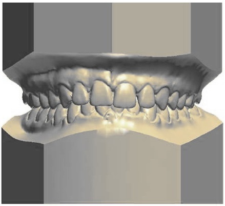 Modelo Evaluación Ortodoncia